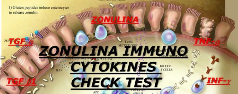 ZONULINA IMMUNO CYTOKINES CHECK TEST